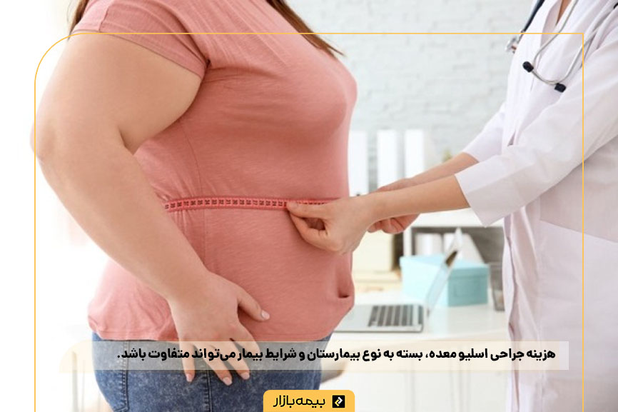 تعرفه اسلیو معده