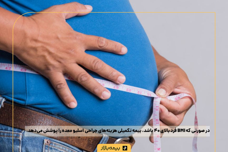 هزینه اسلیو معده با استفاده از بیمه تکمیلی