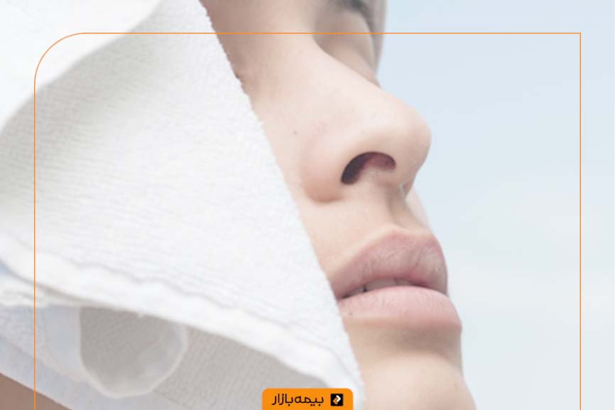 بیمه تکمیلی برای عمل بینی