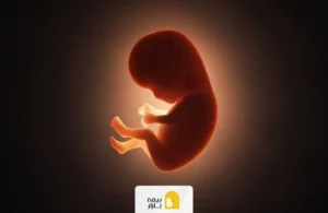 دیه جنین در تصادف